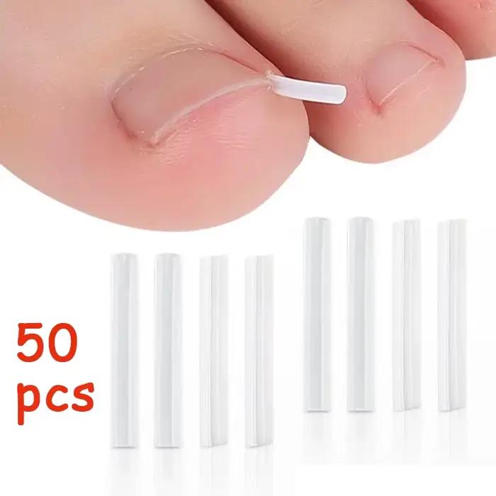 Outil de Correction des ongles incarnés, 50 pièces, tampon de traitement des ongles incarnés invisib