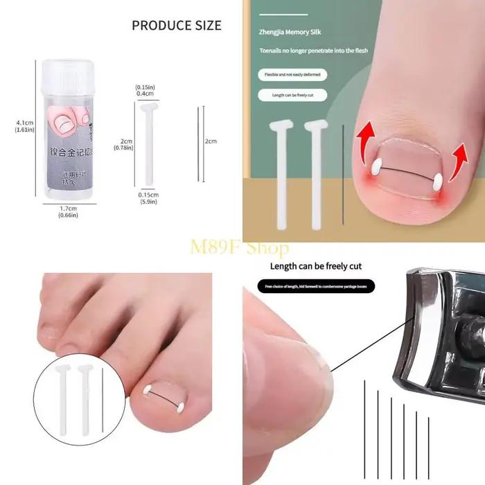 Traitements des ongles incarnés en alliage titane M89F, d'élimination des ongles incarnés pour répar