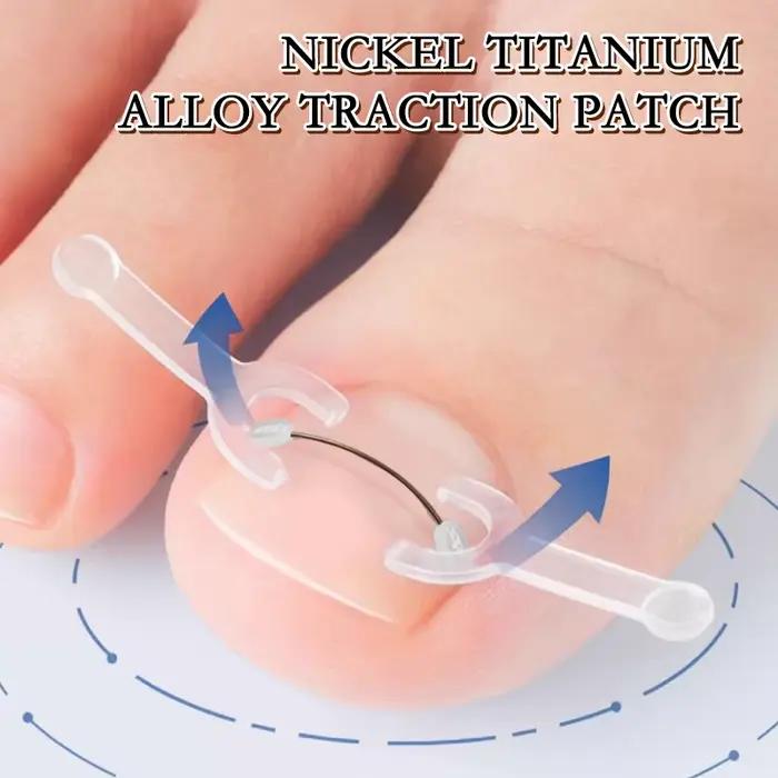 Outil de Correction des ongles incarnés, traitement des ongles incarnés, Patch élastique autocollant, Clip de redressage, outil de pédicure