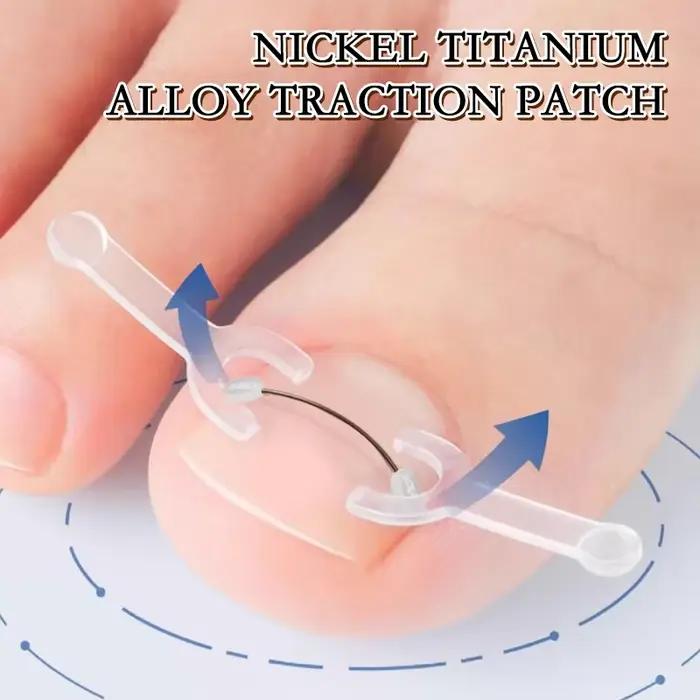 Soins des ongles outil de Correction des ongles incarnés traitement des ongles des orteils incarnés Patch élastique autocollant redressage pince orthèse pédicure aussi