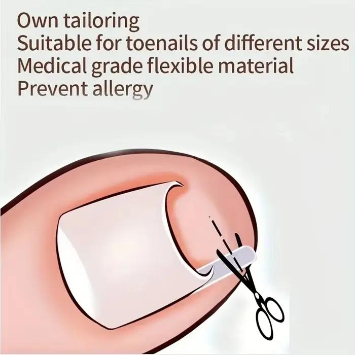 Outil de Correction des ongles incarnés, 50 pièces, tampon de traitement des ongles incarnés invisibles, rainure, Clip de redressage, attelle, outil de soins des pieds