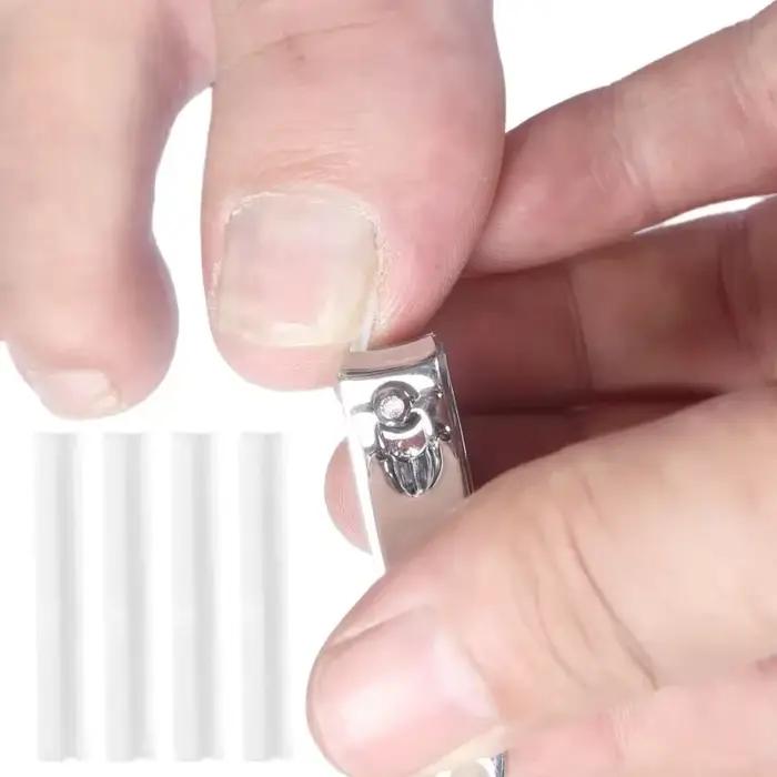 Outil de Correction des ongles incarnés, traitement des ongles incarnés, Patch élastique autocollant, Clip de redressage, outil de pédicure, 10 à 50 pièces