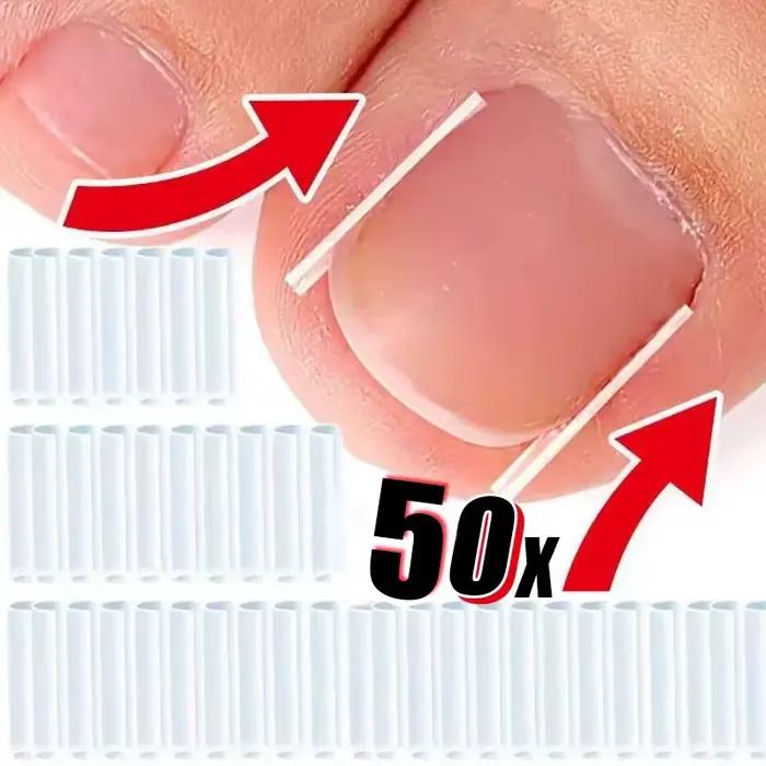 Outil de Correction des ongles incarnés, 50 pièces, tampon de traitement des ongles incarnés invisibles, rainure, Clip de redressage, attelle, outil de soins des pieds