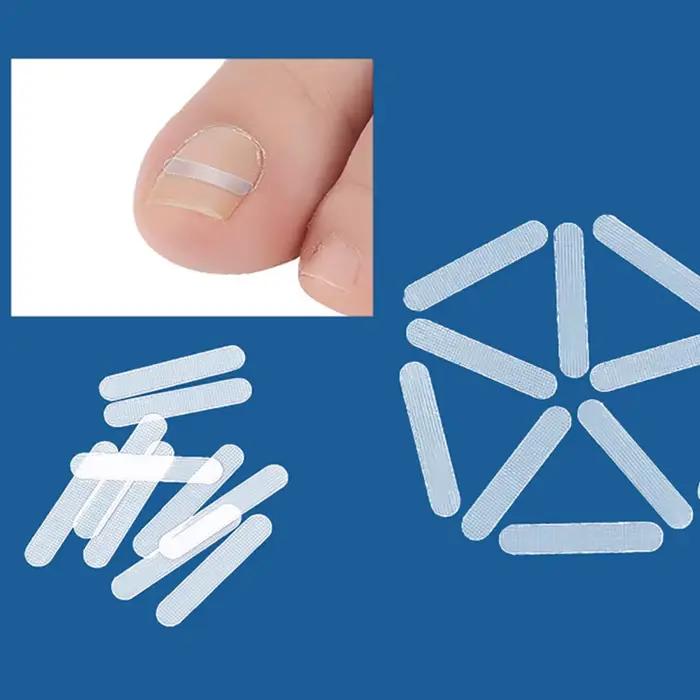 Traitement des ongles incarnés, outil de Correction des ongles incarnés, Patch élastique autocollant, Clip de redressage, attelle, outils de pédicure, 10 pièces