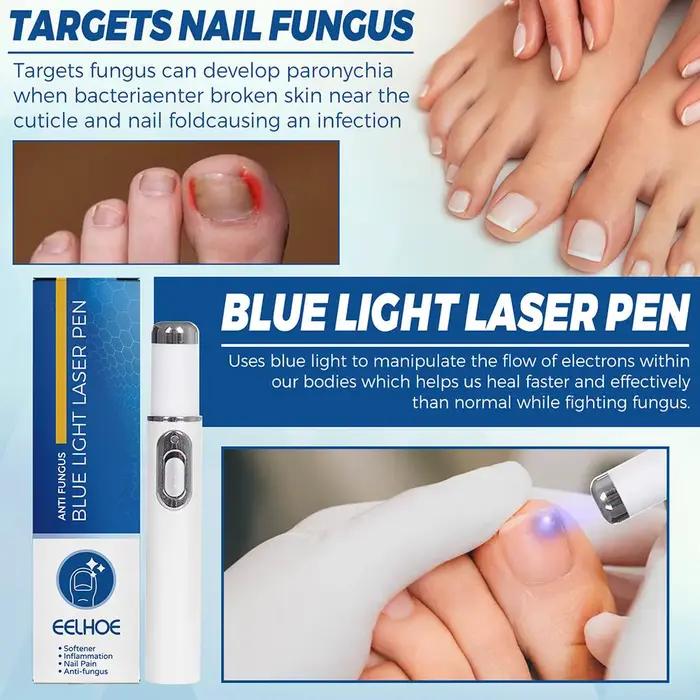 EELHOE – dispositif Laser fongique pour ongles, avec Relaxation des champignons, dispositif de soins pour l'onychomycose, pour réparer les cuticules des ongles des pieds, P K9B9