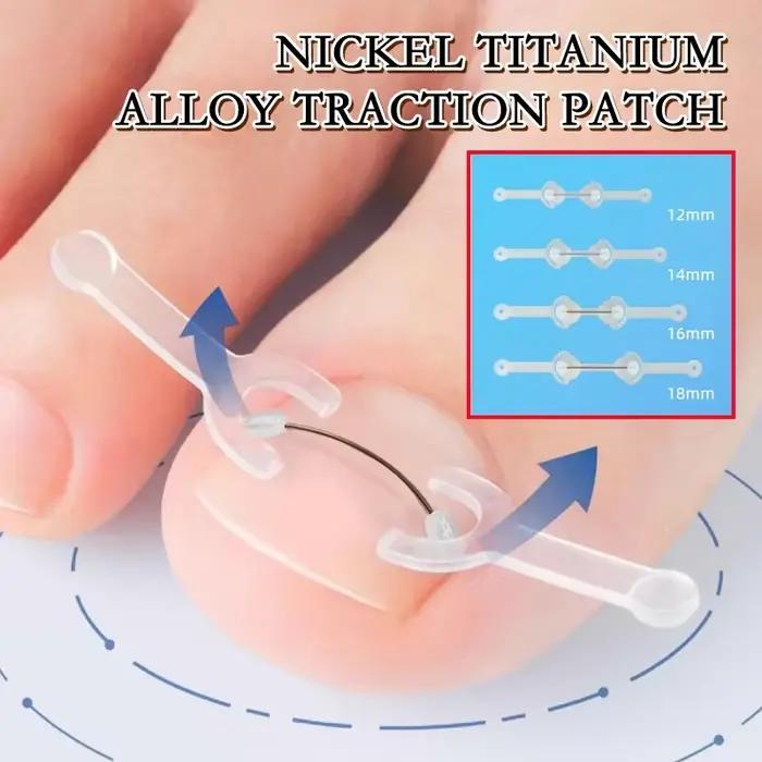 Soins des ongles outil de Correction des ongles incarnés traitement des ongles des orteils incarnés Patch élastique autocollant redressage pince orthèse pédicure aussi