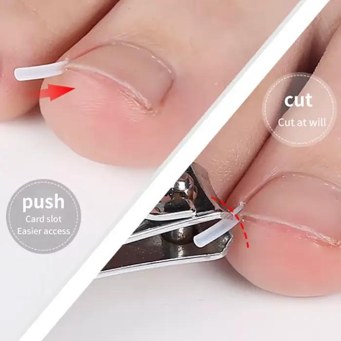 Outil de Correction des ongles incarnés, 100 pièces, traitement des ongles incarnés, Patch élastique autocollant, Clip de redressage, attelle, outil de pédicure